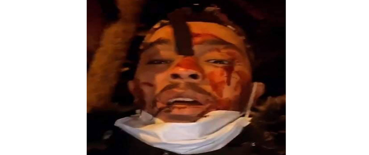 البليدة: الحماية المدنية تباشر مقاضاة صاحب 